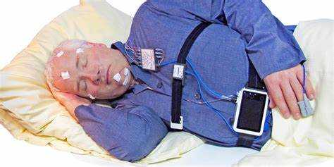 2. 行動式睡眠呼吸監測（OCST）