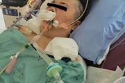 加拿大華人媽媽回家路上捲入槍戰 右眼射瞎頭骨粉碎 昏迷11天 醫療費天價!